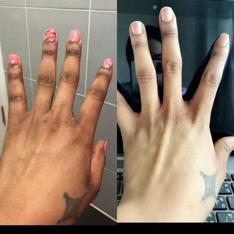 thumb