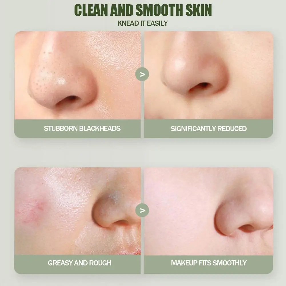 Смягчите светящуюся кожу с помощью алоэ вера отшелушивая сейчас на геле-купите