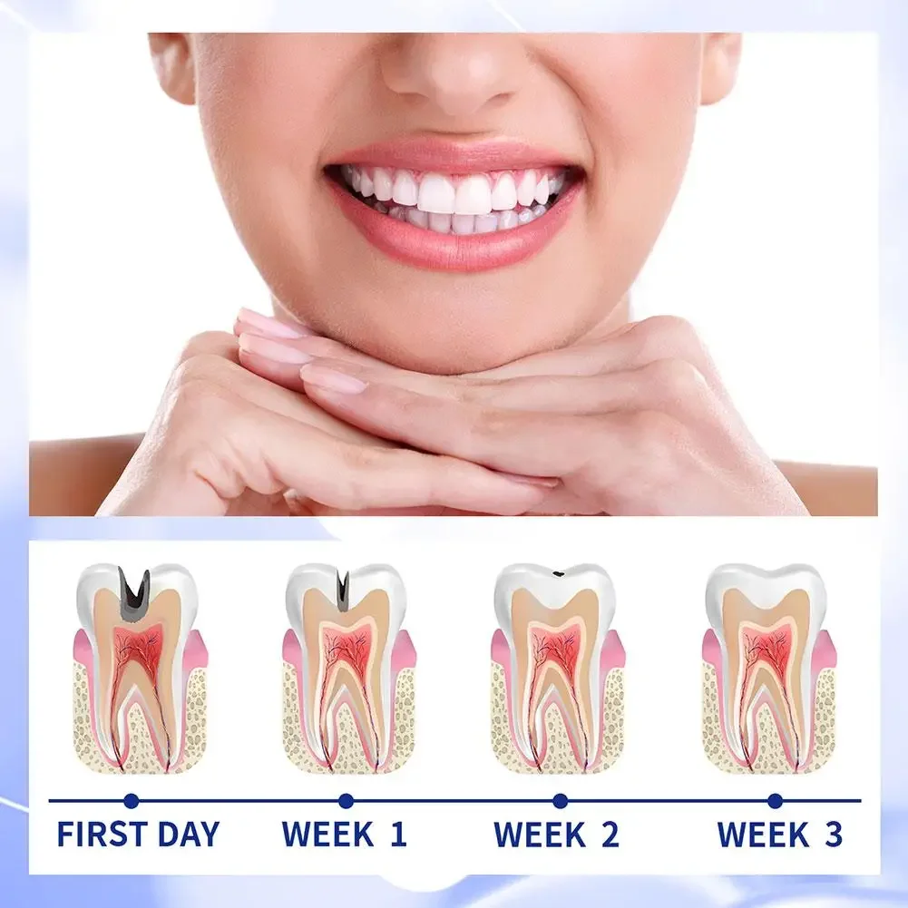 30G Wybielanie zębów Usuwanie pasty do przeciw wnękowi Nowe plamy Pielęgnacja oddechu Świeży W9T1