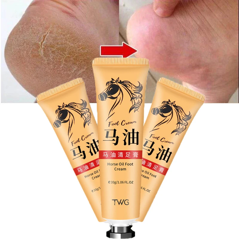 

Крем для ног с конским маслом для лечения ног, крем для удаления омертвевшей кожи, уход за ногами, предотвращение сухой трещины, антисушилка, увлажнение кожи, 30 г