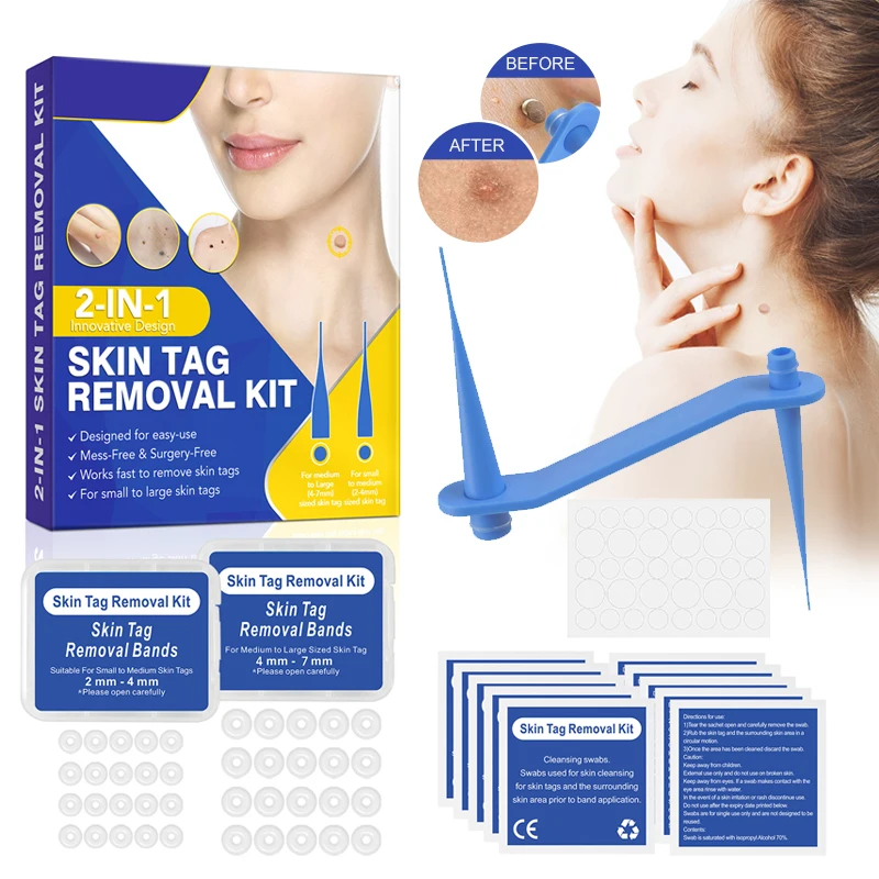 

Blue Set 2-IN-1 Skin Tag Removal Kit Skin Tag Mole Removal Wart Rubber Bands Double Head Skin Tags For Face Neck Care Tools