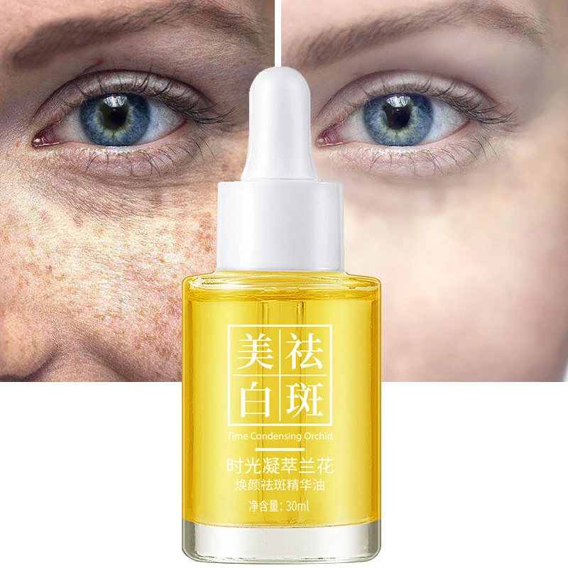 

Whitening and Freckle Removal Time Condensation Orchid Essence Oil Spot Dissolving Oil Moisturizing Moisturizing and Hydrating