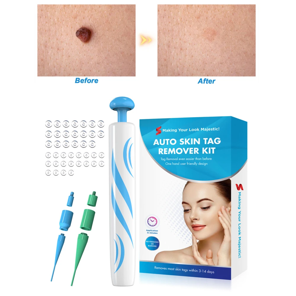 

Painless Skin Tag Remover Mole Wart Removal Kit Auto Skin Tag Removal Corn Remover Wart Blemish Removers Beauty Skin Care Tool