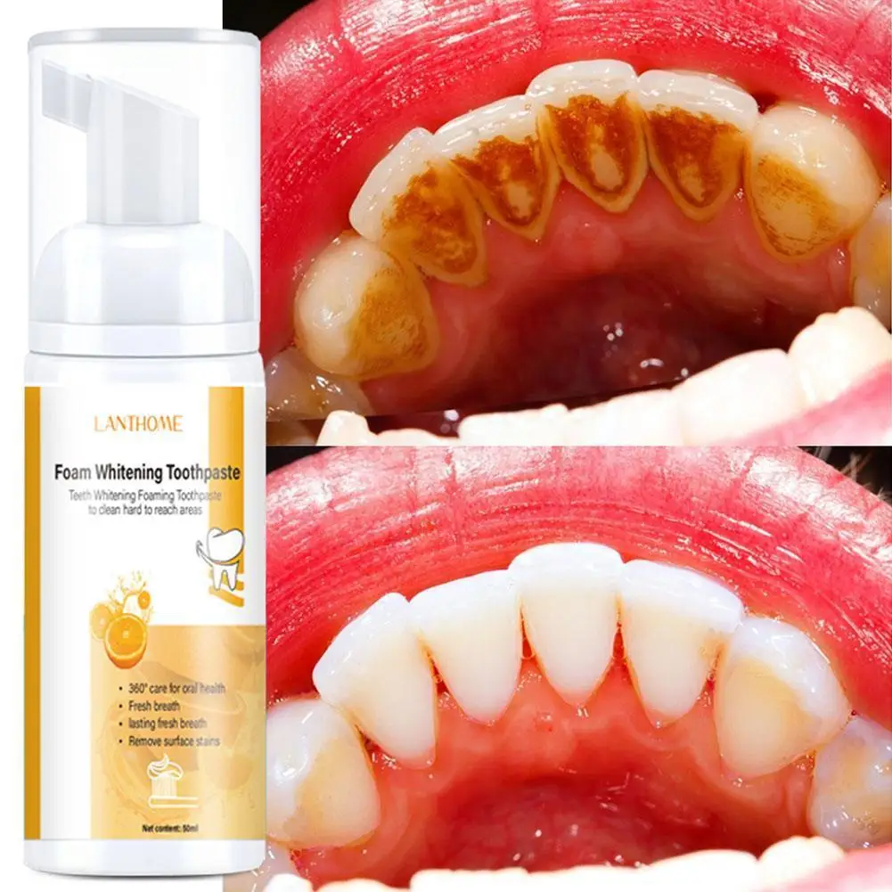 

50ml Fruit Flavored Tooth Whitening Mousse Foam Tooth Breath Toothpaste Cleaning Removal Stains Bad Breath Fresher Teeth N1E0