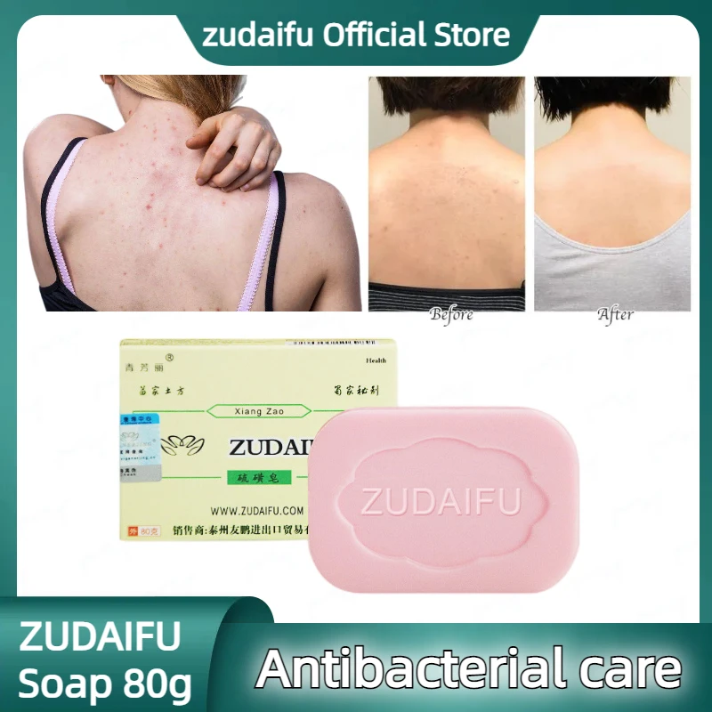 

10pcs ZUDAIFU Soap Psoriasis Eczema Ointment Acne Seborrhea Suitable All Skin Diseases Anti Fungus Soap Bathing Care 80G