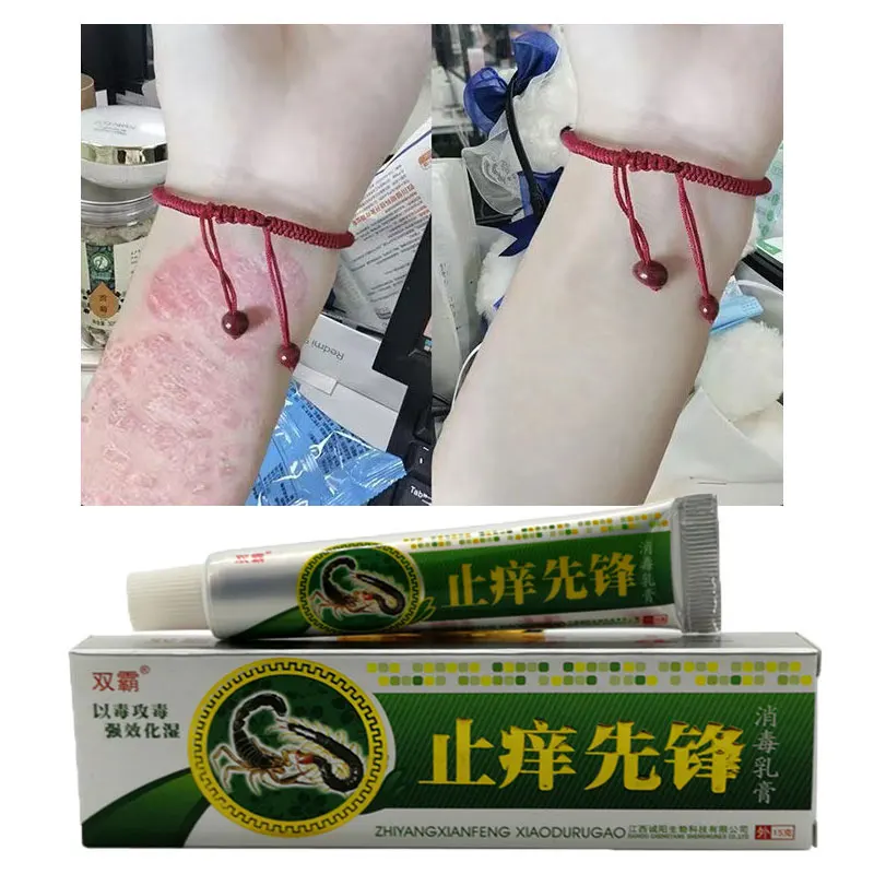 

Psoriasis Ointment Psoriasis eczema skin Useful Dermatitis Anti Fungal Infection Skin DermatiTis Cream