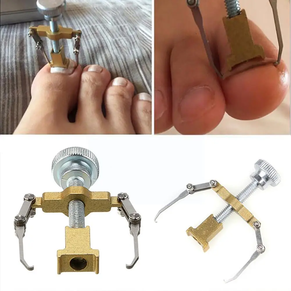 

Paronychia Ingrown Toenail Correction Tool Pedicure Corrector Care Treatment Brace Foot Toe Fixer Nail Clip Straightening Y3i0