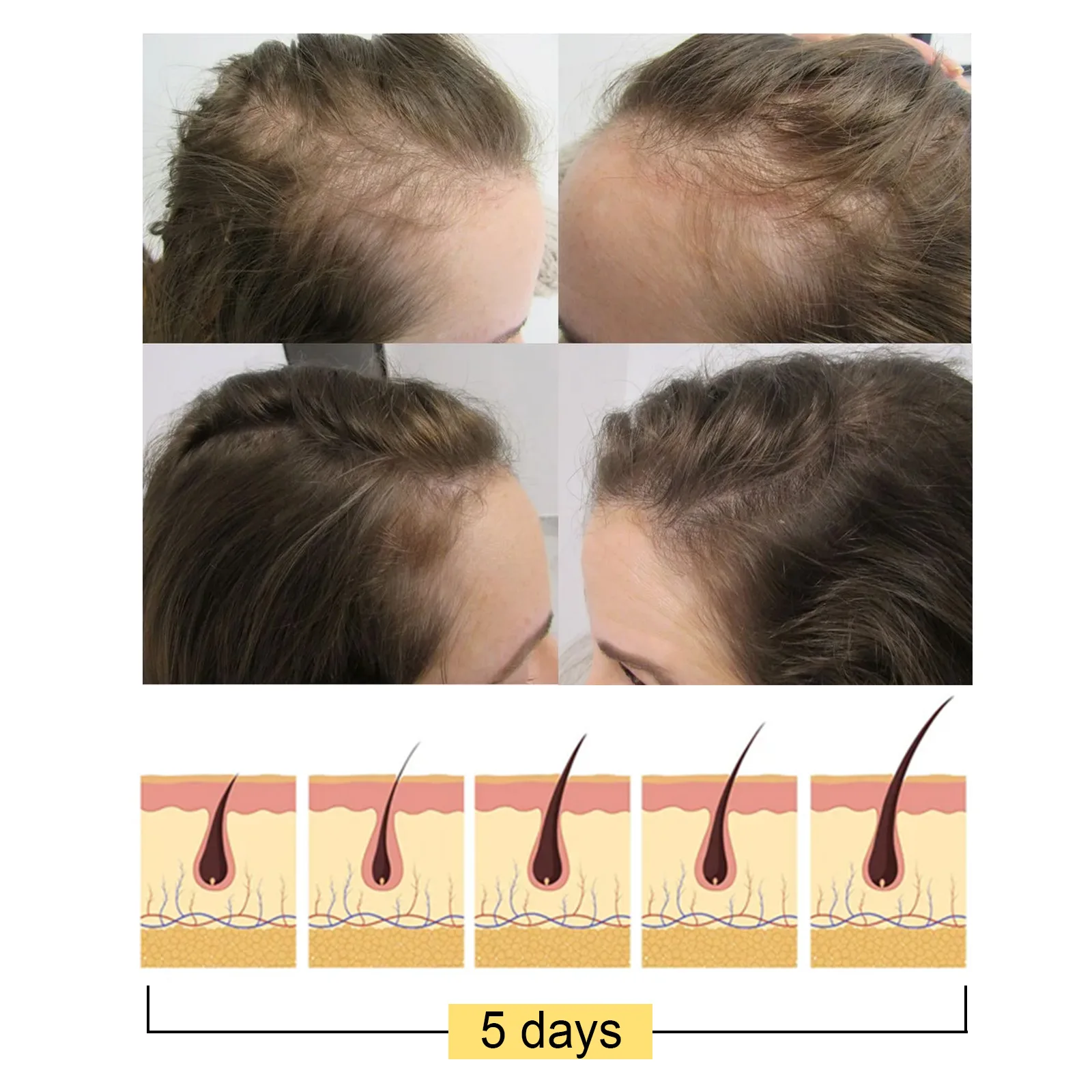 1 шт. шампунь мыло содержит рисовый экстракт увлажняющий уход за волосами