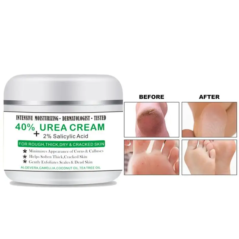 

Urea Cream Body Care Moisturizing Cream Exfoliating Mani Pedi Anti Chapping Cream Health & Beauty Repair Chapped Go Calluses