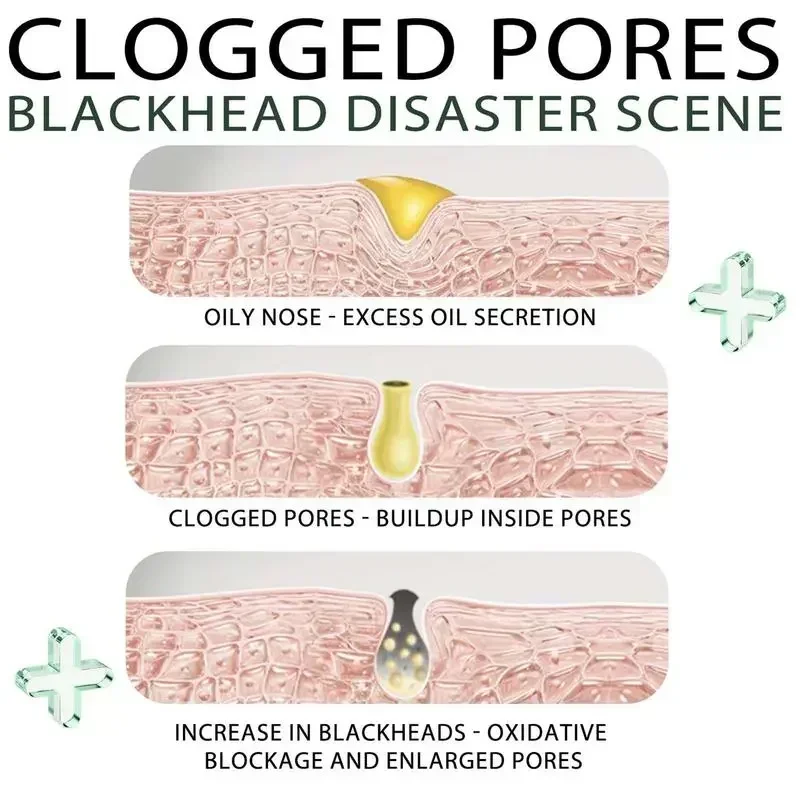 Лидер продаж крем для удаления черных точек полоски носа натуральные пор на