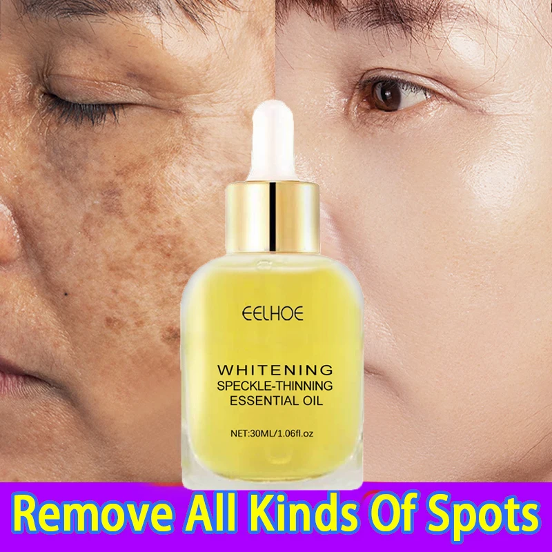 Freckles Whitening Serum Remove Dark Spots Melasma Brighten Lighten Melanin Essence Oil Improve Dull Anti-aging Face Skin Care