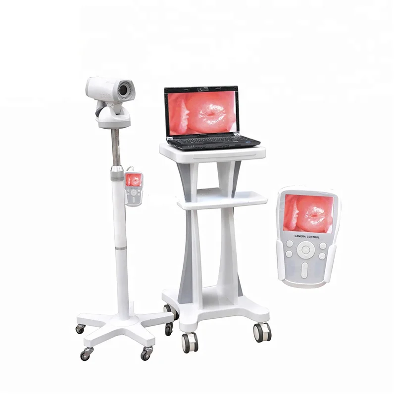 

LH9800A Hot sale Digital Electronic Video Colposcopy for Gynecology/Portable Gynecological Machine Woman
