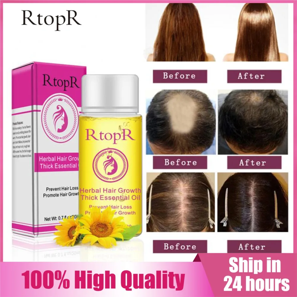 

RtopR Hair Oil Prevent Hair Loss Product Fast Hair Growth Essential Oil Easy To Carry Hair Care Nursing Treatment For Hair Fall