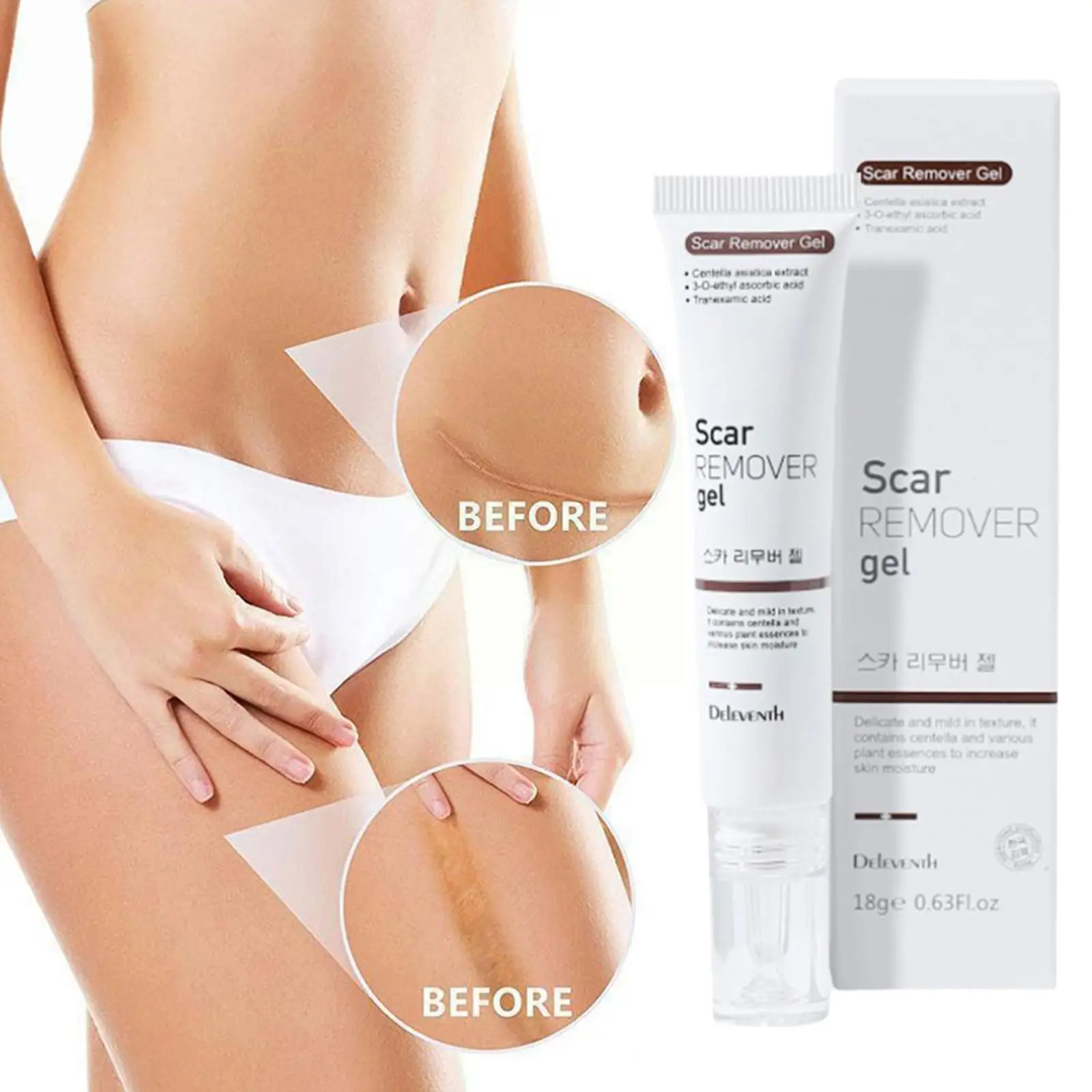 

Acne Scar Removal Cream Repair Maternity Stretch Marks Skin Surgical Burn Lighten Scars Remove Treatment Smooth Scar Damage I0H9