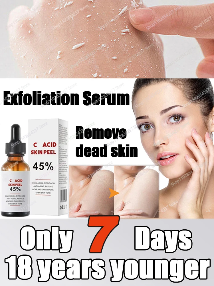 Высокое качество 45% отшелушивающая кислотная кожа супер сила - Цена: 4849