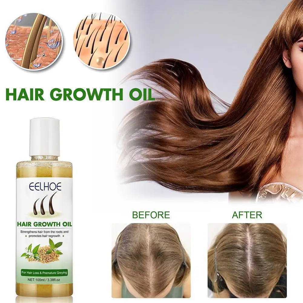 

Уход за узкими волосами, масло для восстановления поврежденных, косметический уход, эссенция для выпадения волос, уход за кожей головы для ж...