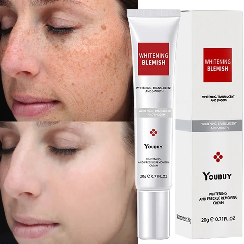 

20g Whitening Freckle Cream Effective Remove Melasma Freckle Dark Spots Melanin Moisturize Cream Brighten Smooth Face Skin Care