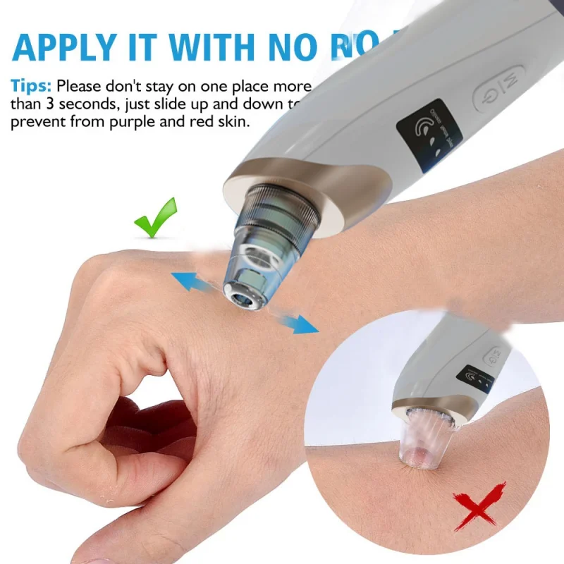 Blackhead Remover Pore Vacuum Cleaner Black Dot Nose Acne Facial Cleaning Pimple Beauty Tool New Arrive |