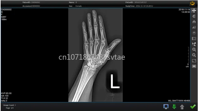 Медицинский рентгеновский детектор Medsinglong CSL 17*17 дюймов