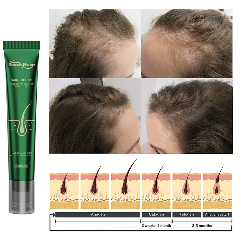 

Быстрое масло для роста волос против выпадения волос Восстановление корней волос Питательная Жидкость для женщин и мужчин лечение истончения волос сыворотка для роста
