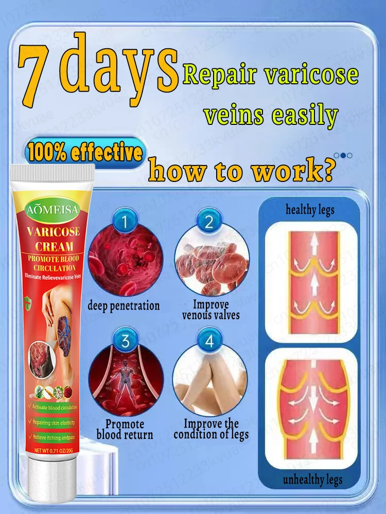 Мазь от варикозного расширения вен 7-дневное лечение опухших кровеносных сосудов