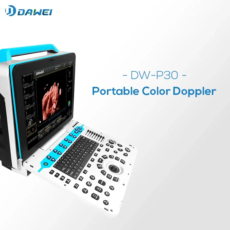 DW-P30 3d 4d портативний кольоровий доплерівський ультразвуковий апарат ecografo portatil і