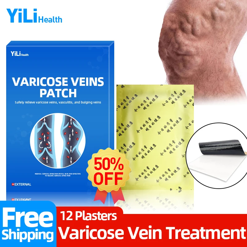 

Пластырь для лечения варикозного расширения вен, воспаления, флебит, бриллиантовый крем, васкулит, здоровье