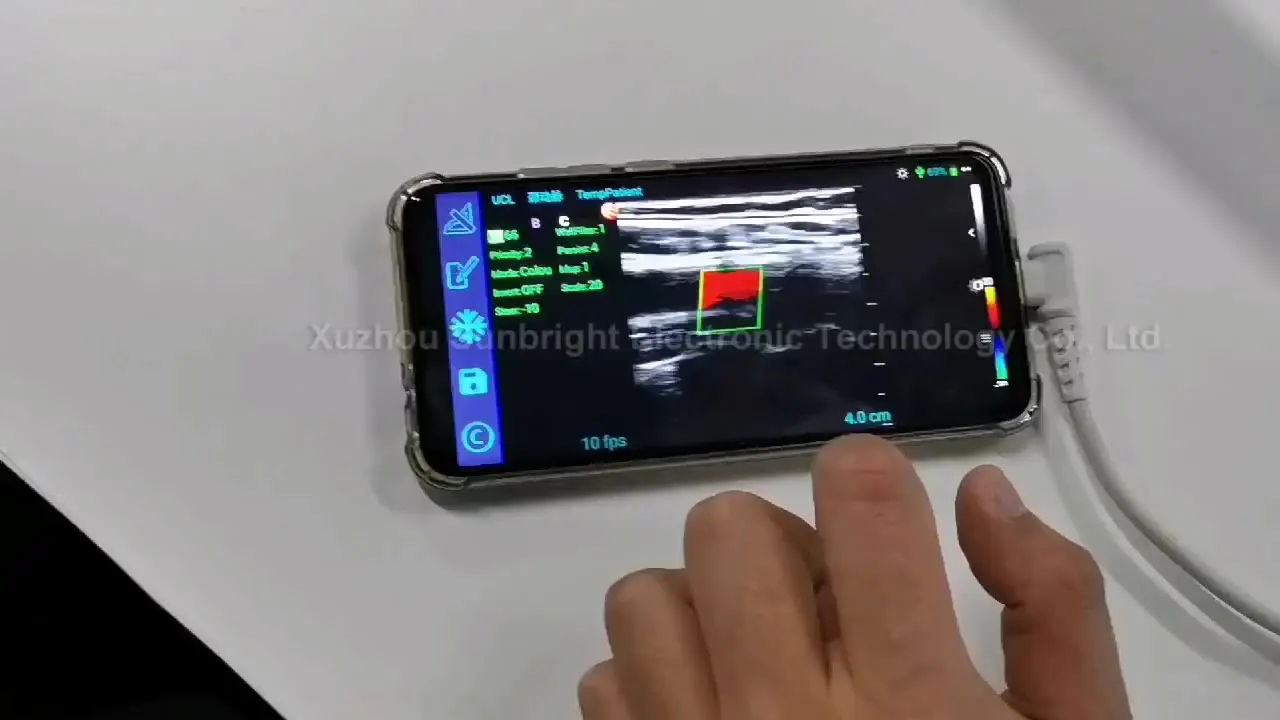 

ecograph ultrasound echo scanner Ultrasound probe for Android color Doppler USB wireless Linear Probe