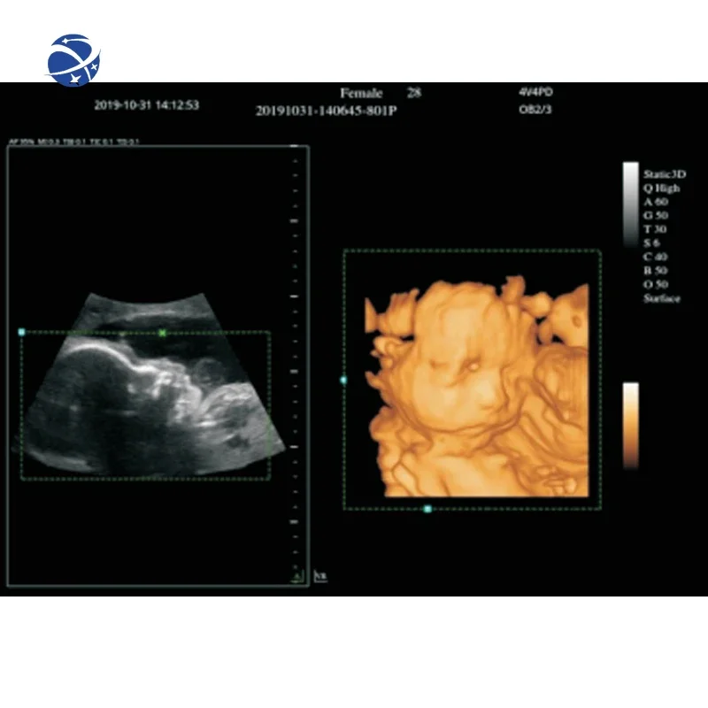 Портативный 2d 3d 4d эхокардиографический портативный цветной допплер-сканер для