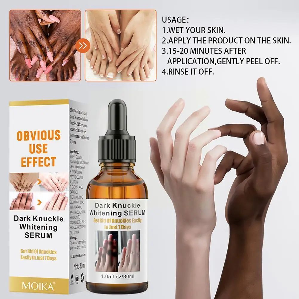 

Dark Knuckles Fast Whitening Serum Pigmentation Correctors for Black Skin Hand Knuckle Elbows Knee Intense Stains Remover S J0S0