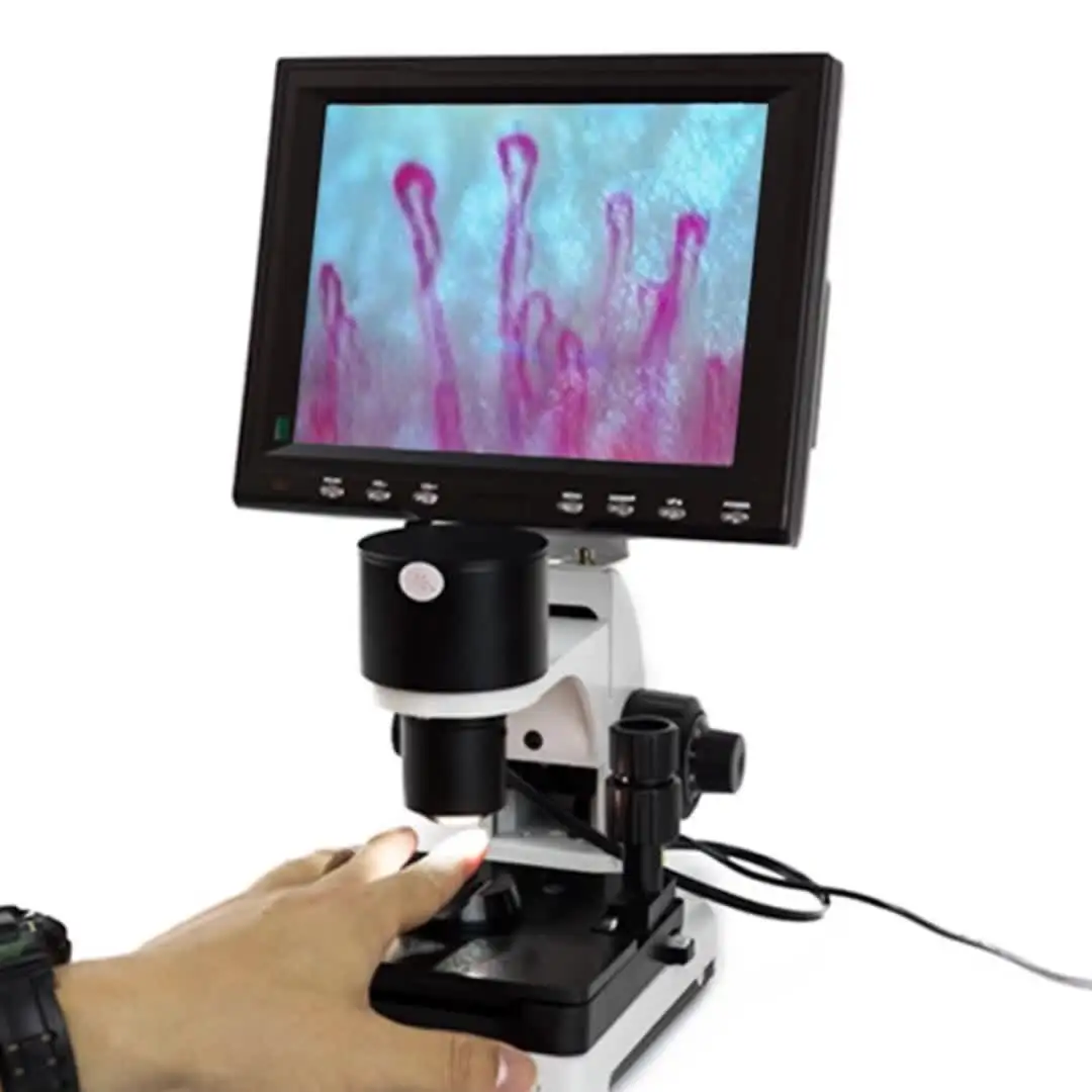 

LED Display Nailfold Capillary Endoscope/Microcirculation Testing Machine with CE