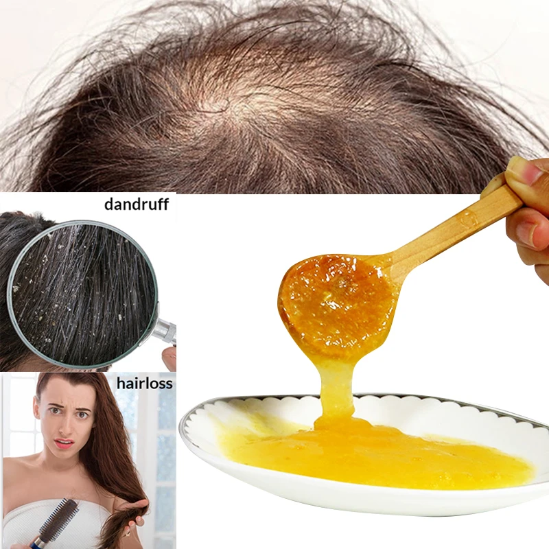 250g OMY LADY Ginger Anti Hair Loss Shampoo promote hair growth Shampoo Hair Thick Fast Growth Serum Herbal Liquid For Women Men