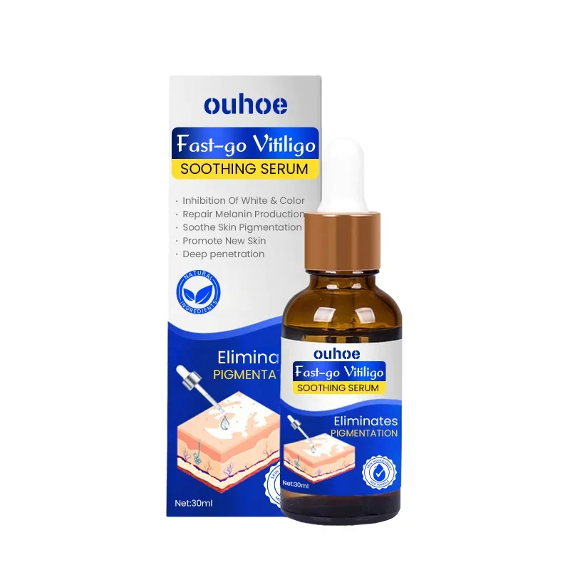 Сыворотка для лечения Vitiligo лампа роста пигмента Ringworm Tinea удаление пота и белых