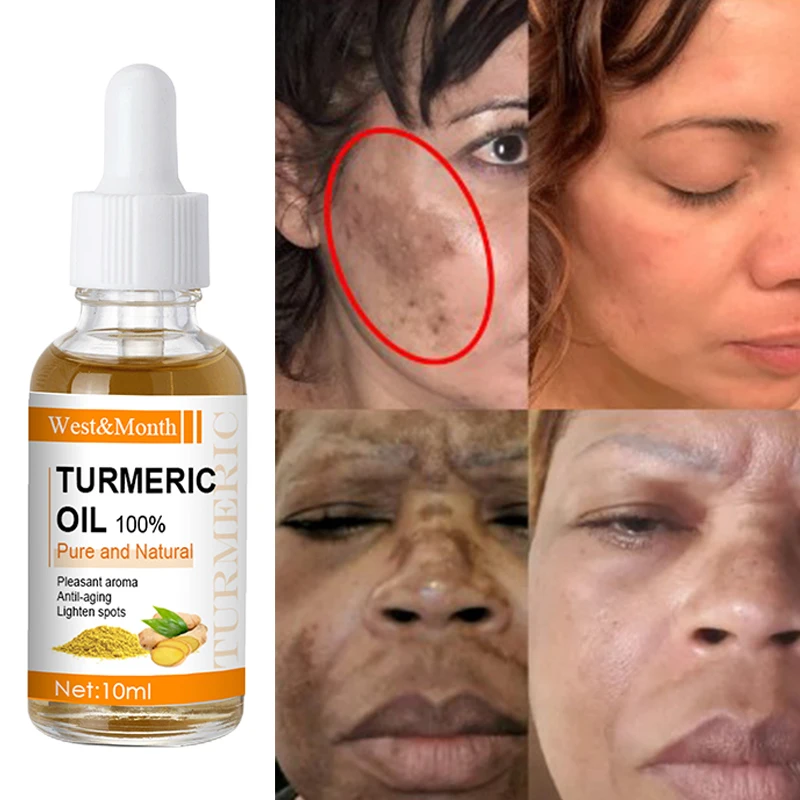 Organic Turmeric Freckles Serum Fade Fines Line Repair Lessen Black Spot Removal Pigment Melanin Brighten Skin Beauty Face Care