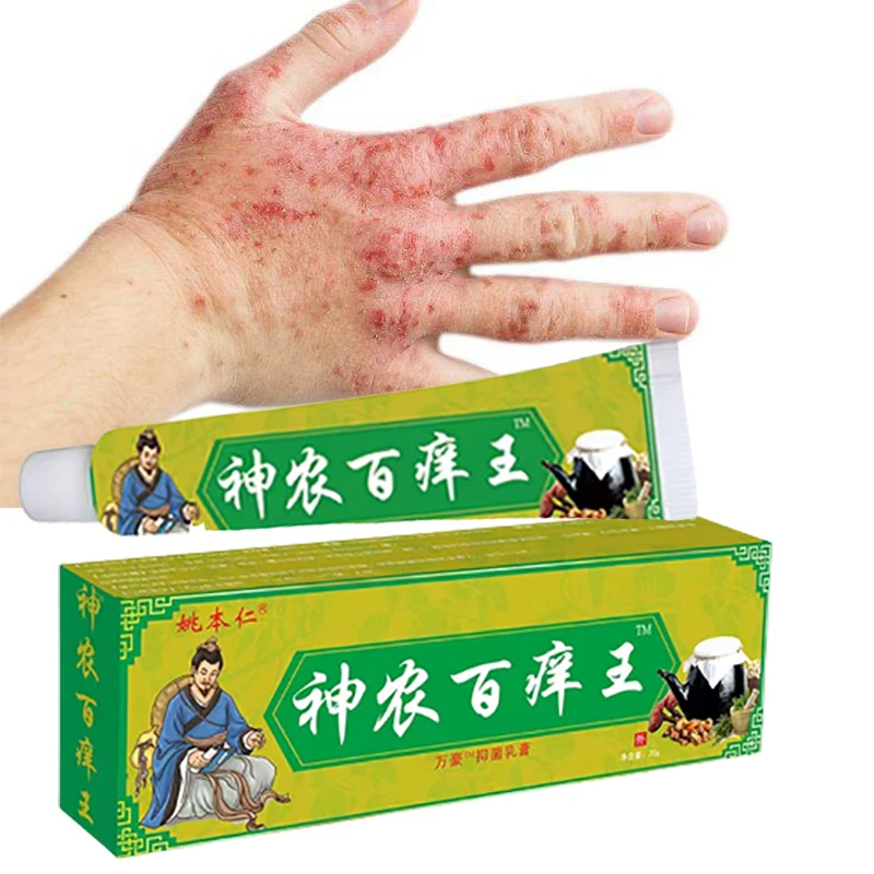 

1pcs Eczema Anti-itch Ointment Relieving Itchy Skin Mosquito Bites Rash Allergy Chinese Herbal Medicinel Psoriasis Cream C011