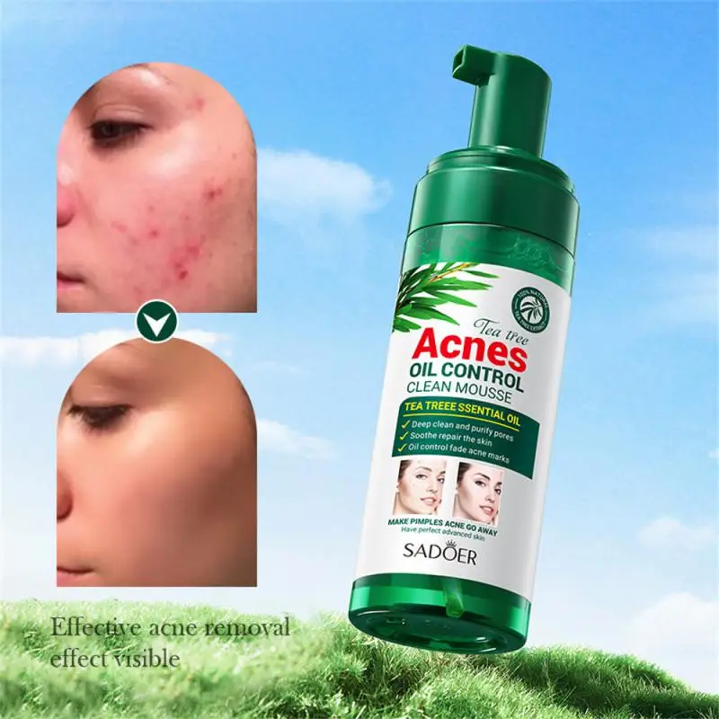 

Face Cleanser Wash Moisturizer Foaming Face Cleanser Remove Blackhead Deep Cleaning Oil Control Whiten Korean Skin Care Products