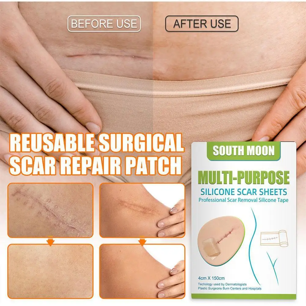 

1 Roll Reusable Silicone Scar Removal Patch Sheet Burn Surgery Flatten Scar Gel Skin Adhesive Sticke Repair Soft Self Strip