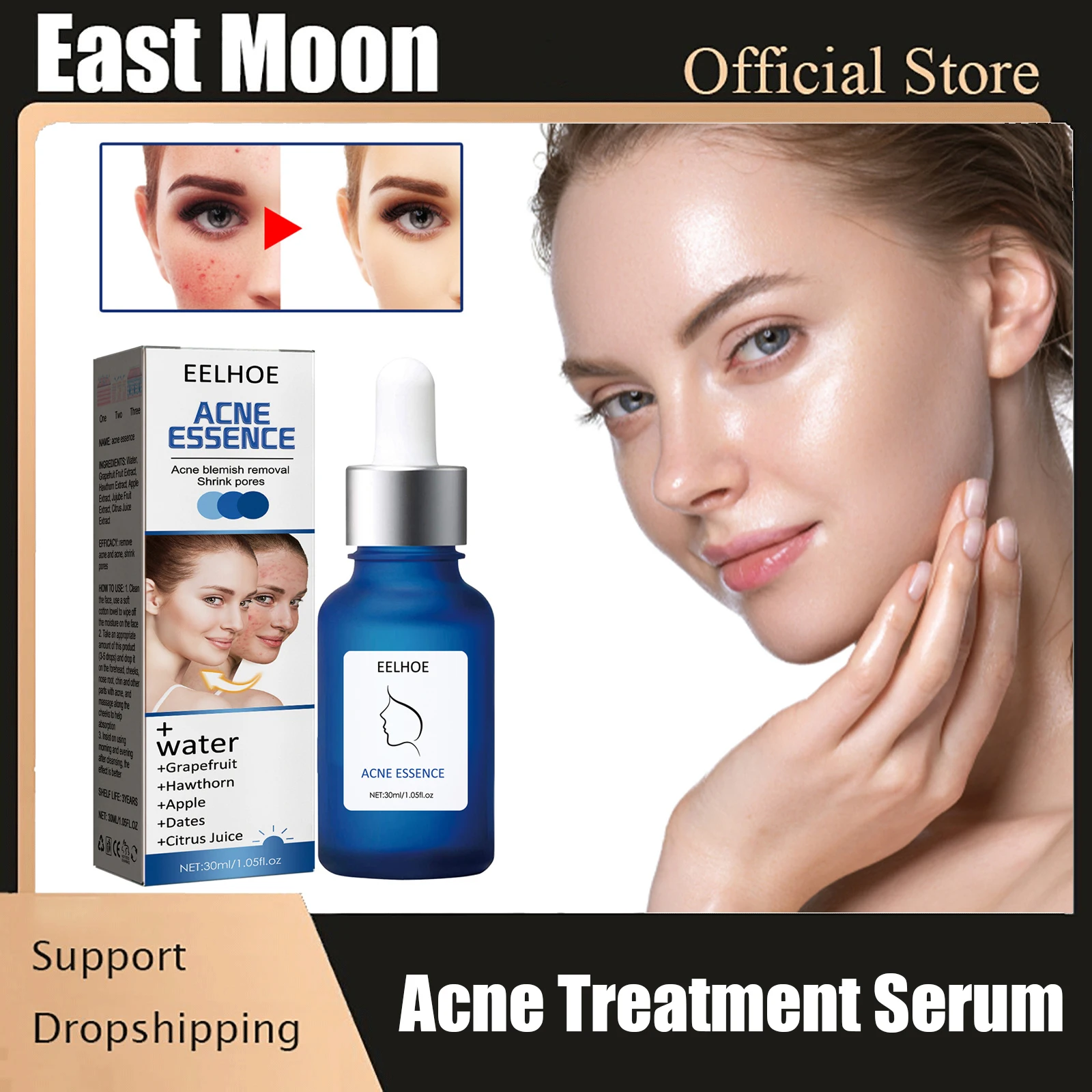 

Acne Treatment Face Serum Oil Control Pore Shrinking Gentle Repair Acne Scar Removal Facial Serum Korean Skin Care Products 30ml