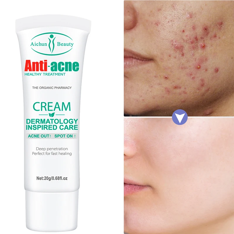 Acne Removal Face Cream Acne Spots Scar Repair Treatment Oil Control Shrink Pores Whitening Moisturizing Smooth Facial Skin Care