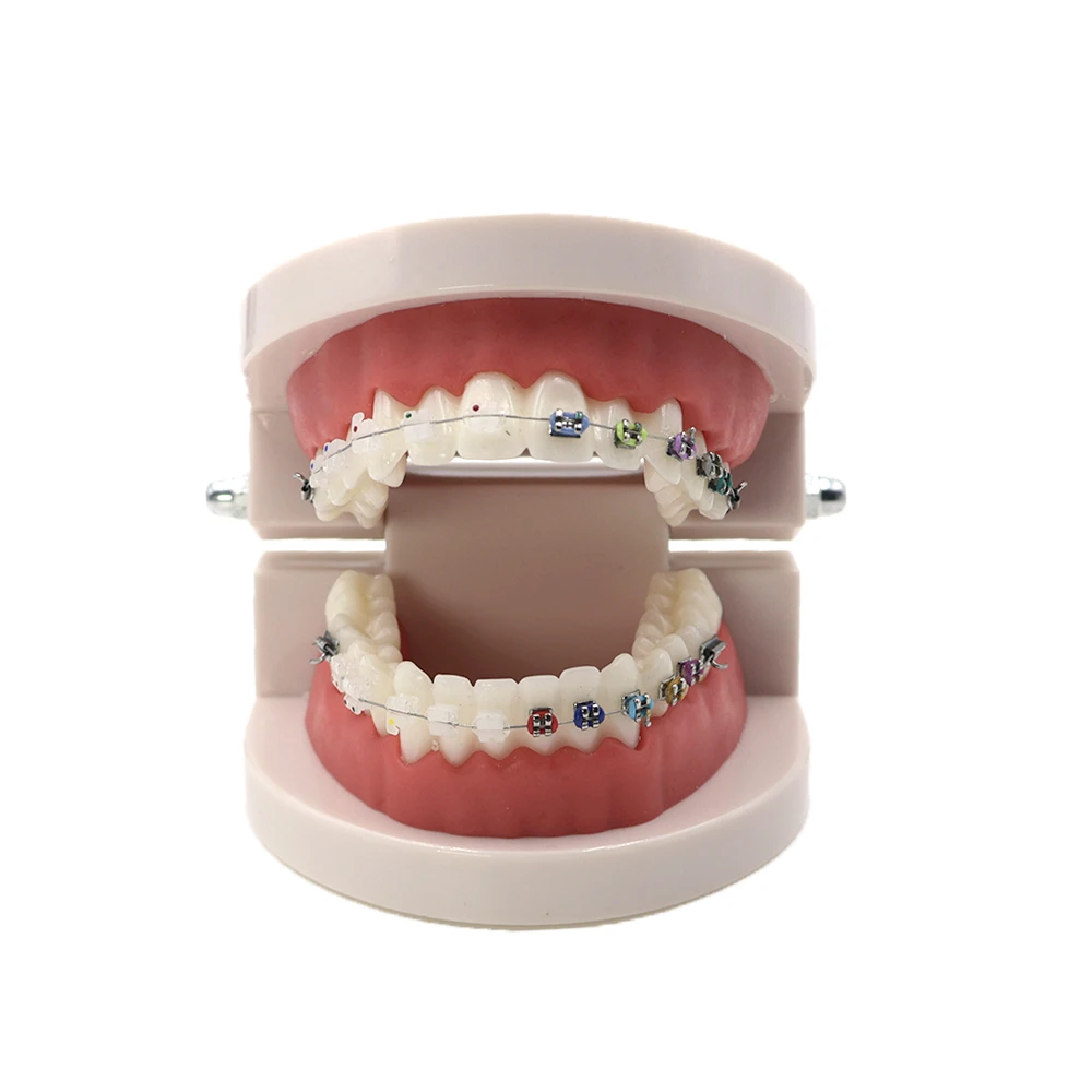 

Dental Orthodontic study teeth Model Typodont w/ half Metal & ceramic brackets