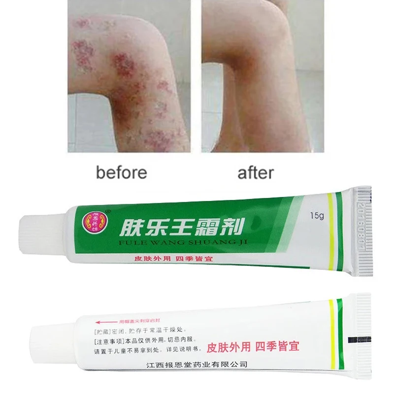 

Hot New Dermatitis Eczematoid Ointment Psoriasis Creams Skin Antibacterial Herbal Cream