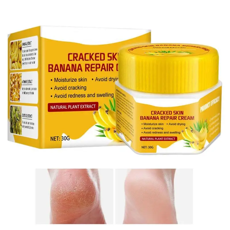 

Sdotter Banana Repair Dry Crack Feet Care Cracked Heel Moisturizer Foot Repair Moisturizing Remove Dead Skin Foot Care Products