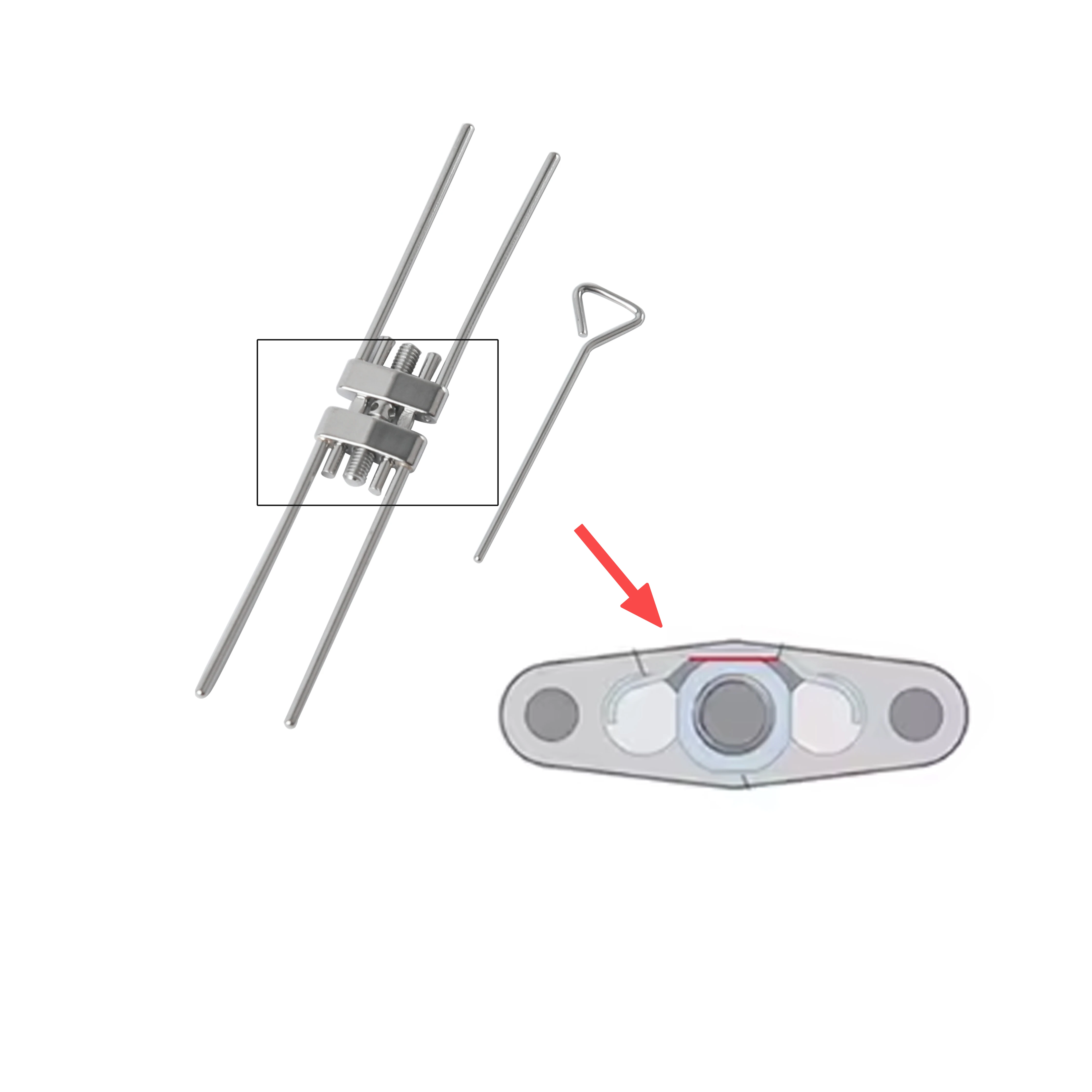Фото Стоматологический ортодонтический расширитель для десны, винтовой, с быстрым расширением, с поворотными ключами, для ортодонтических брекетов, инструмент для стоматологии, CE №3