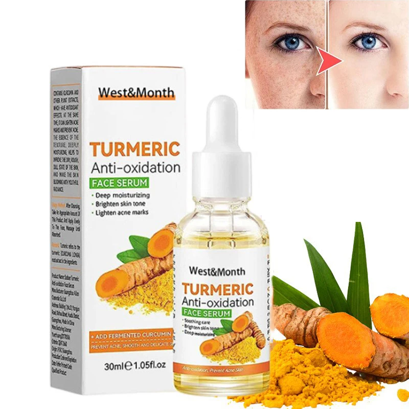 

30ml Turmeric Freckle Whitening Serum Moisturizing Repair Skin Brighten Fade Dark Spot Acne Marks Remover Essence Face Care 30m'