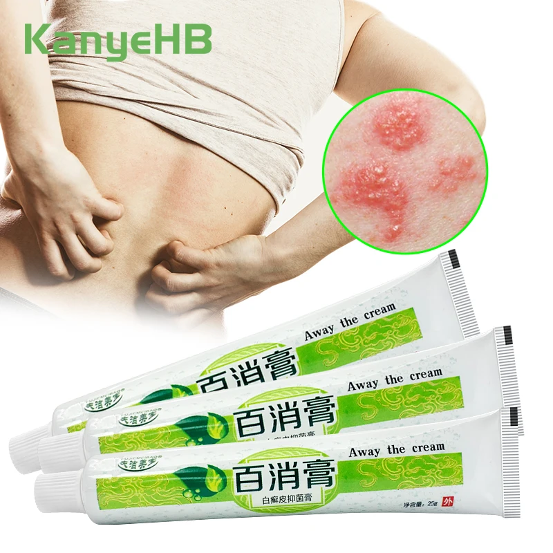 

3pcs Herbal Antibacterial Cream Anti-itch Ointment Relief Psoriasis Eczema Skin Rash Urticaria Desquamation Treatment Balm A1302