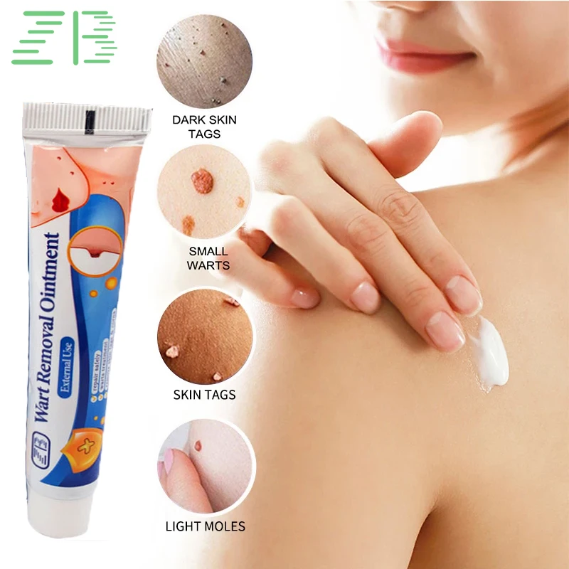 

Натуральный травяной экстракт, лечение бородавок, мазь 2 шт., сильнейший фотокрем, ярлык для кожи, средство для удаления бородавок, повязка н...