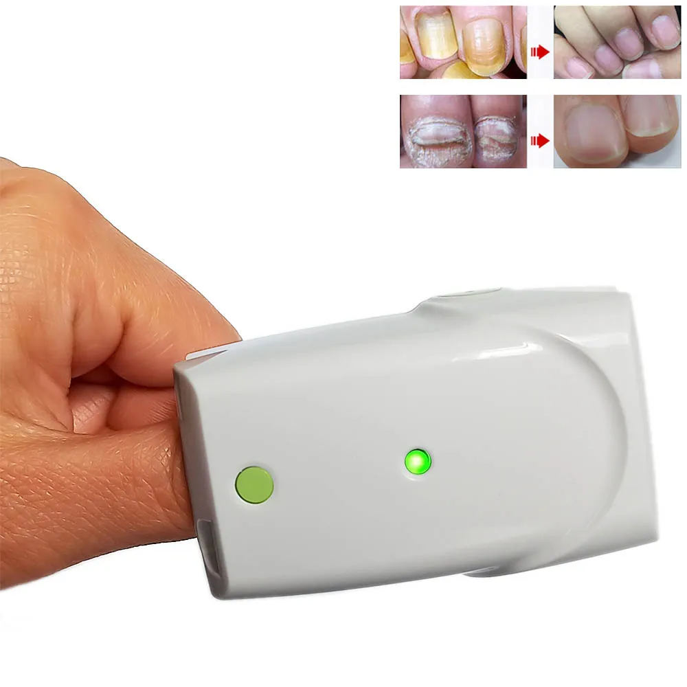 Nail Cleaning Laser Device Painless Nail Fungus Laser Treatment Nail Infection Onychomycosis Cure Nail Fungal Infections