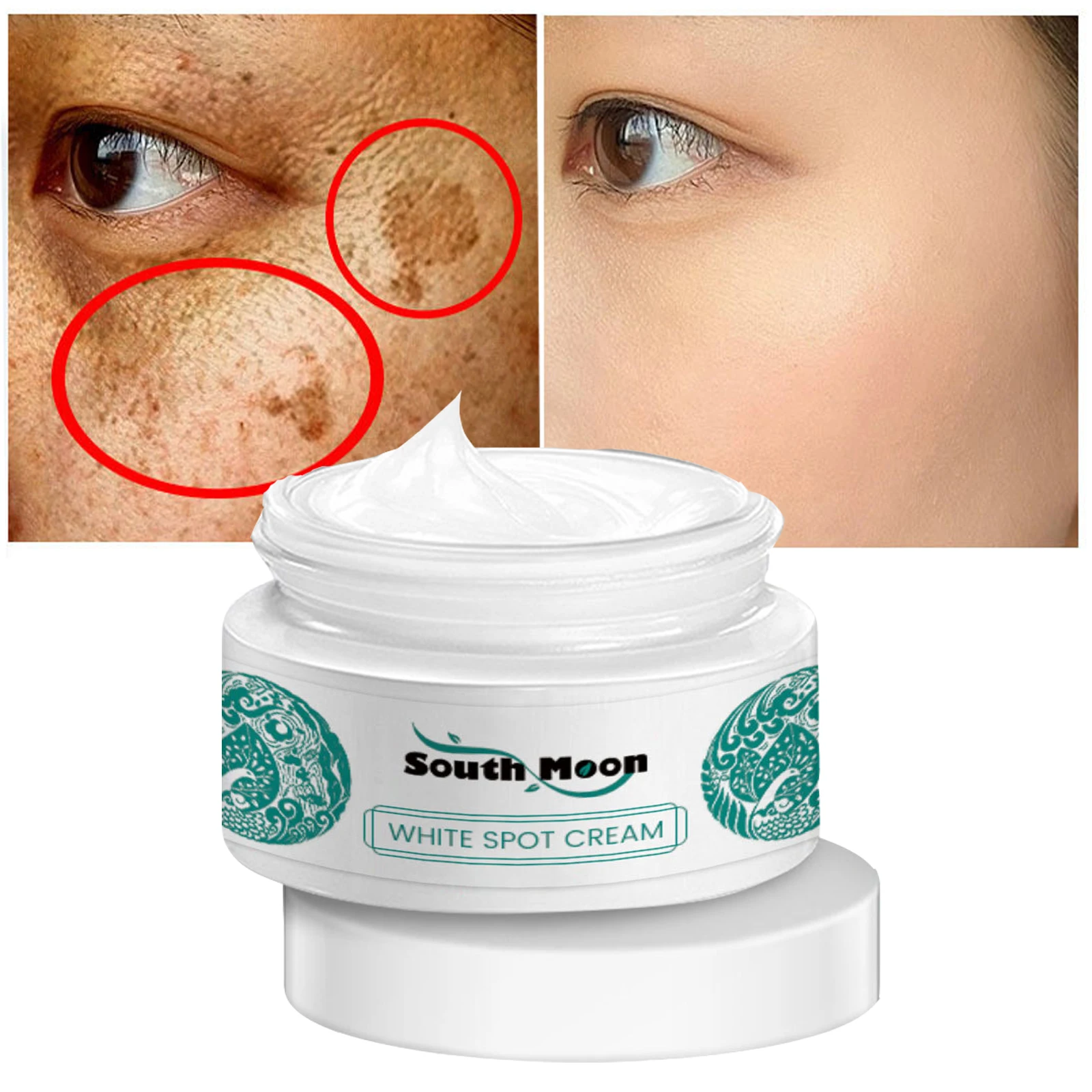 

Nicotinamide Whitening Freckle Face Cream Remove Dark Spots Melanin Melasma Fade Pigmentation Moisturizing Brightening Skin Care