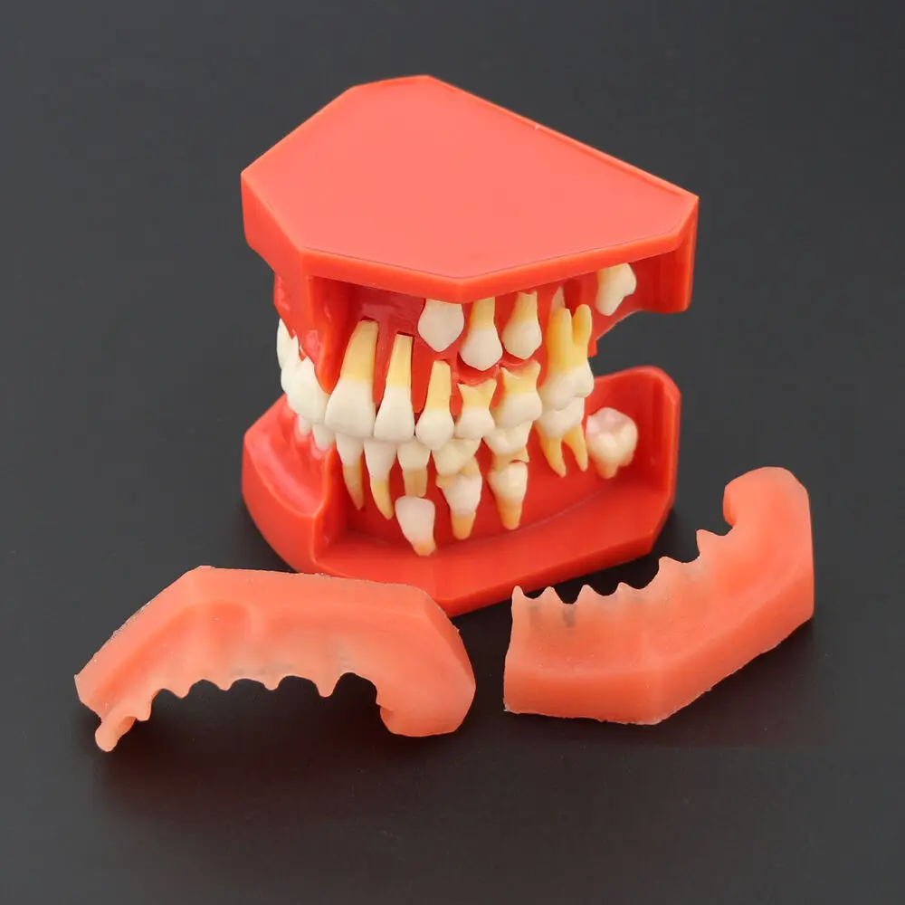 Dental Teeth Permanent Tooth Alternate Demonstration Study Teach Model 4006# AU