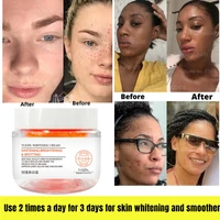 intense facial whitening and freckle removing cream acne removing moisturizing repair anti aging skin rejuvenation to chloasma